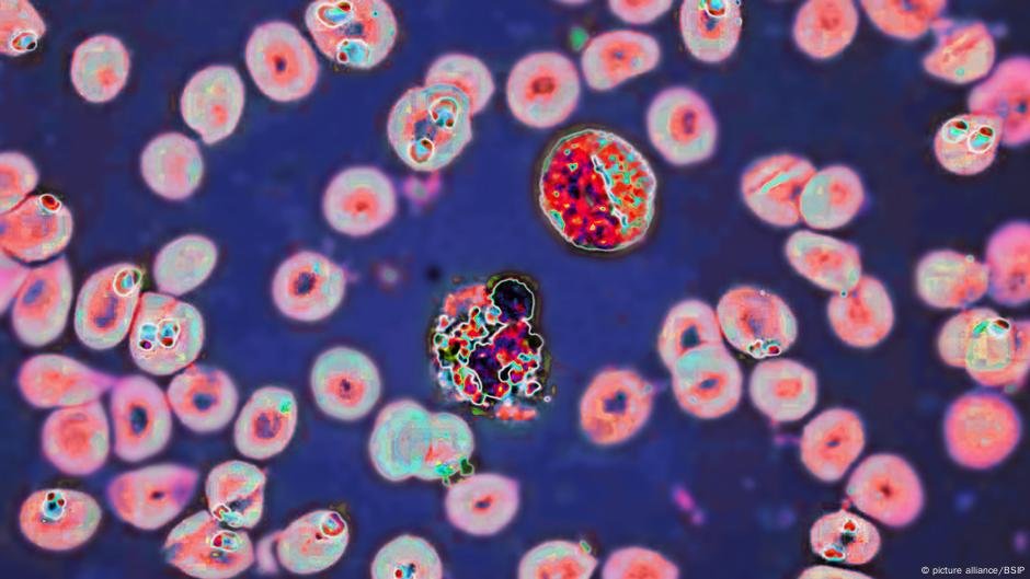 O que sabemos - DW - 03/03/2025