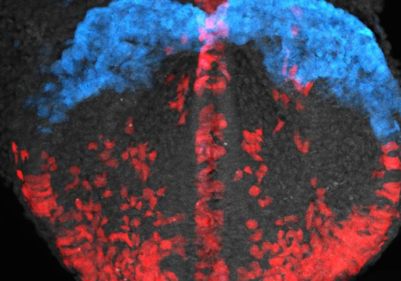 Na Califórnia (EUA), esta mulher parou o carro na rodovia e salvou um cãozinho perdido. Motoristas que vinham atrás perceberam e pararam a estrada para ajudar. - Foto: FOX26 News